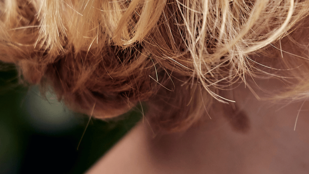 Juckender Kopfhaut mit natürlichen Mitteln beikommen