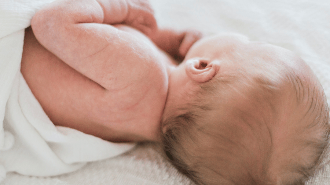 Hautausschläge bei Babys - das ist zu beachten