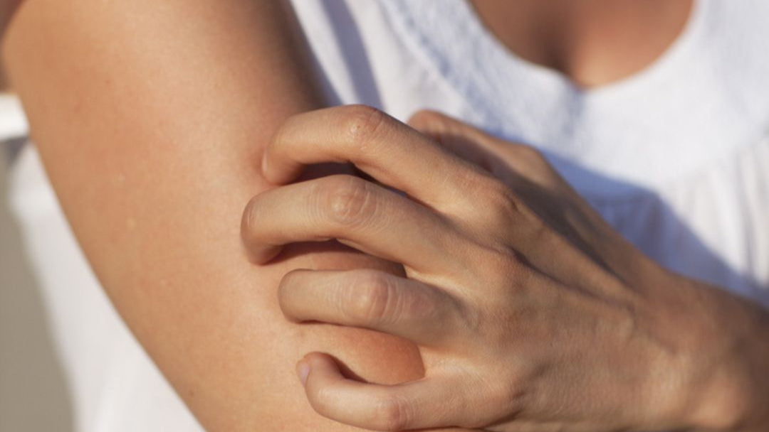 Kleines Allergen mit großer Wirkung