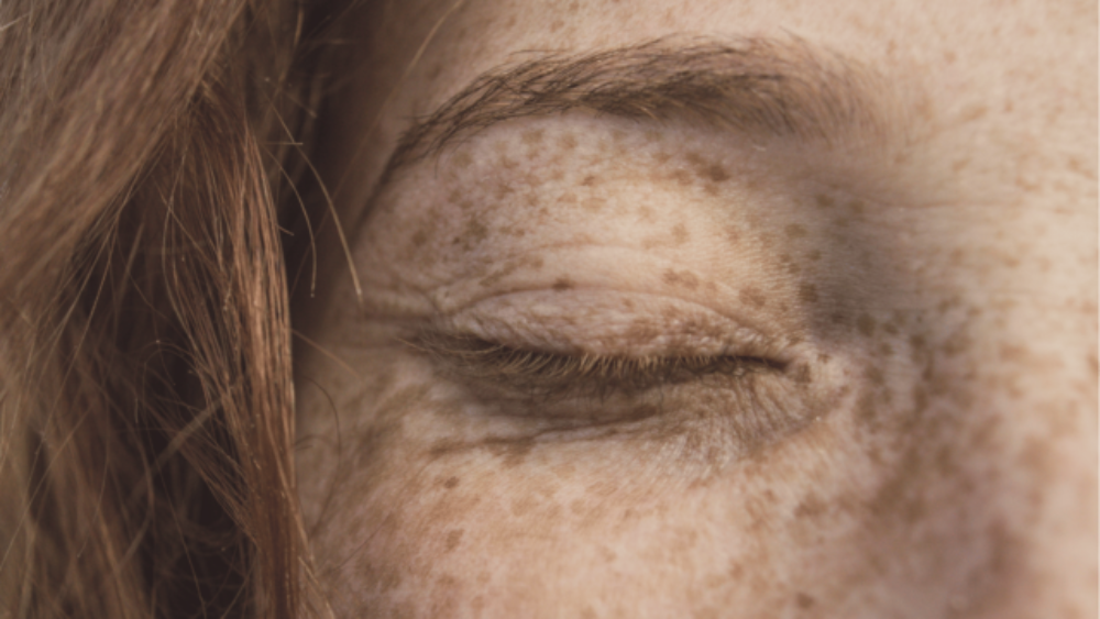 Der Zusammenhang zwischen Selbstliebe, Selbstakzeptanz und Neurodermitis