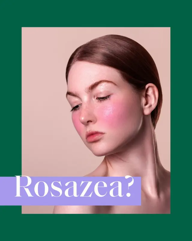 🖊 Feedback unserer Verwender (Beispielfoto): "Für Rosacea Patienten ist Ihr KAMI SOS Balsam einmalig, ich habe nichts Vergleichbares gefunden. Ich hab nicht mehr mitgezählt, wie viele Cremes und Cortison ich verschrieben bekommen habe. Mittlerweile ist KAMI in meiner Morgenroutine nicht mehr wegzudenken. Ein wirklich großartiges Produkt."
💕Danke für das tolle Feedback!
#weloveourusers #rosazea #neurodermitis #problemhaut #kamihilft