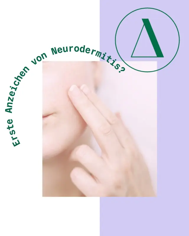 😣 Plötzlich ein Ausschlag im Gesicht?
Rötungen, Juckreiz, kleine Bläschen oder schuppige Stellen? Deine Haut möchte Dir etwas sagen!
Die mögliche Ursachen:
• Stress oder hormonelle Schwankungen
• Duftstoffe oder aggressive Pflegeprodukte
• Lebensmittelunverträglichkeiten
• Beginnende Neurodermitis
💡Wichtig: Hör auf Deine Haut, bevor sie laut wird.
🫶 Unsere Empfehlung:
KAMI SOS Hautpflegeöl – mit hautberuhigendem Hanfsamenöl & antioxidativem Sanddorn.
KAMI SOS Hautpflegebalsam – reich an Sheabutter, Nachtkerzenöl & pflanzlichen Wirkstoffen gegen Juckreiz & Entzündungen.

100 % natürlich, vielfach getestet und in der Wirksamkeit bestätigt – für empfindliche, gereizte und neurodermitische Haut.
👉 Deine Haut braucht keine Chemie. Sie braucht Ruhe, Regeneration und KAMI.

#kamihilft #neurodermitis #problemhaut #madeinaustria #naturkosmetik